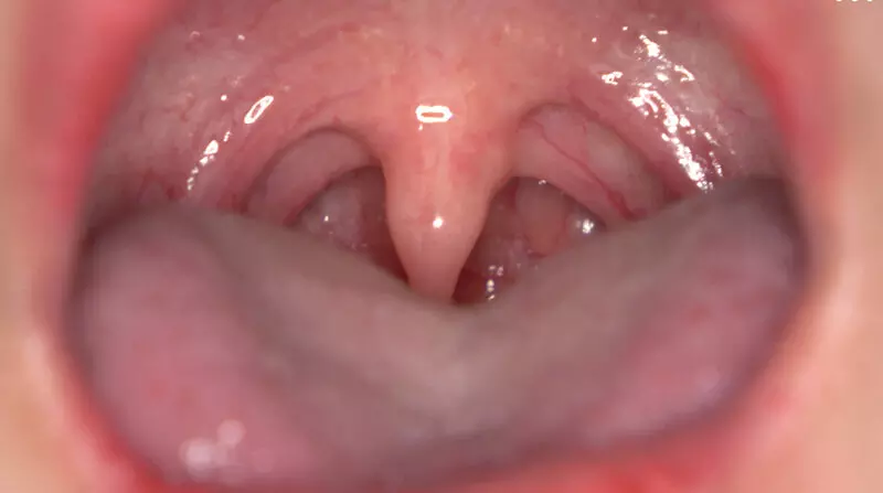 h_1416ad02007 「【歯・口腔フェチ】新人女優相楽さゆなちゃんの口内観察＆巨大女フェチ」わかしラボWAKA-078 相楽さゆな 9