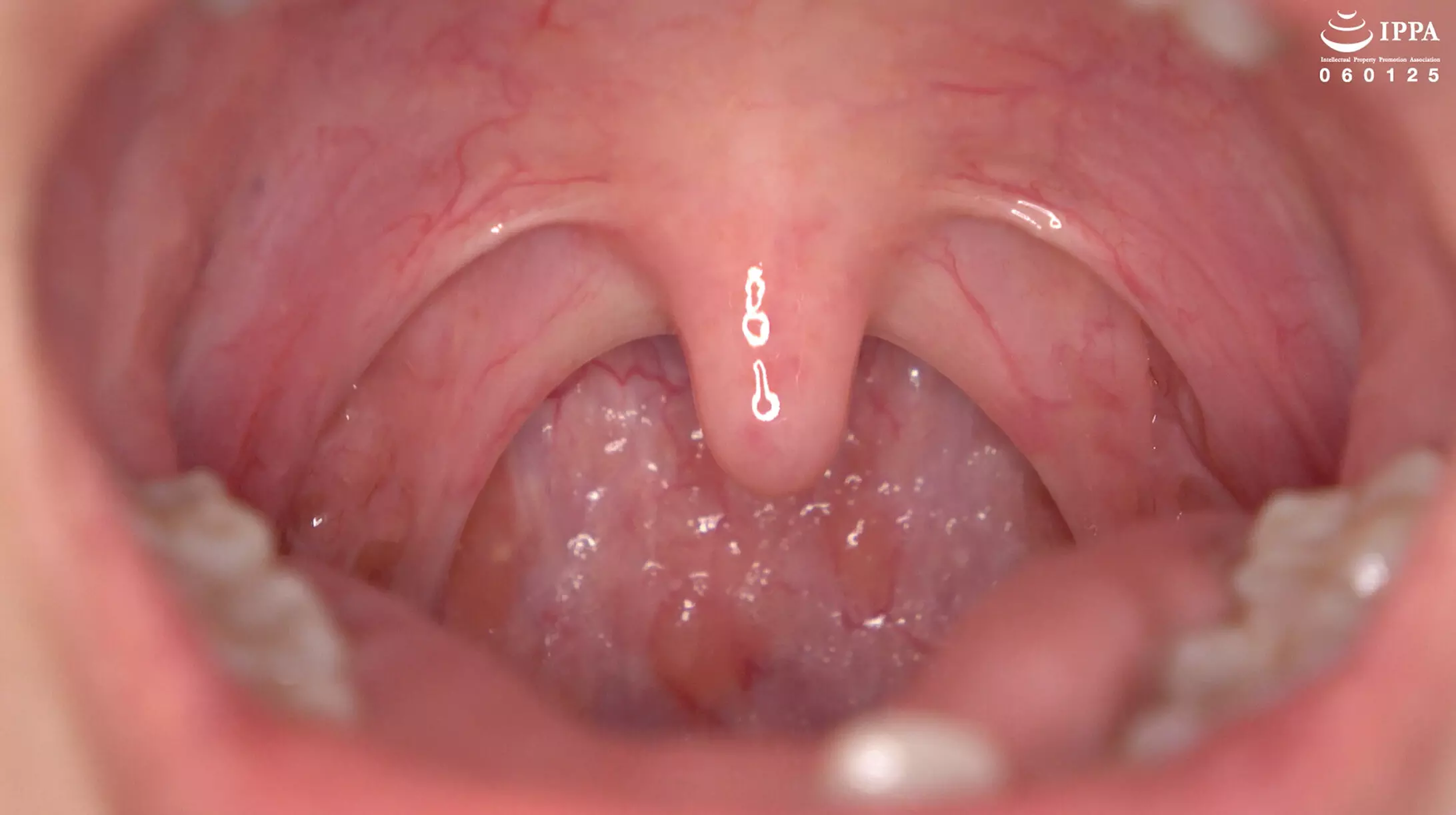 h_1416ad02042 「【歯・口腔フェチ】くすぐったがりの谷田かりなちゃんの口内観察！＆巨大女フェチ」谷田かりな